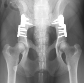 Αμφοτερόπλευρη DPO (Εικόνα 2)