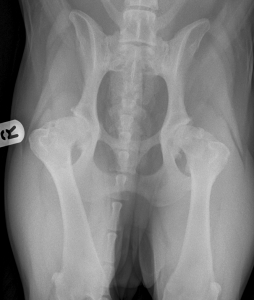 Αμφοτερόπλευρη δυσπλασία ισχίων (Εικόνα 1) Αμφοτερόπλευρη δυσπλασία ισχίων (Εικόνα 1)